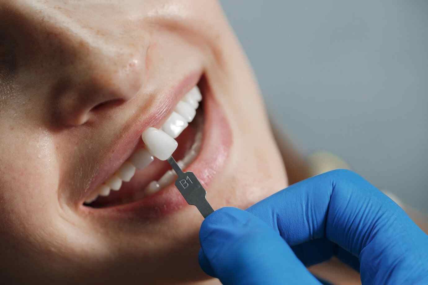 dental implants in waukesha