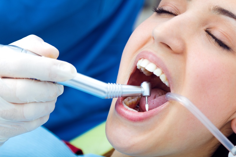 how dental fillings in waukesha restore cavities